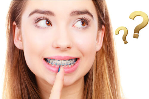 Sự thật về niềng răng thay đổi khuôn mặt, là đẹp lên hay xấu đi?